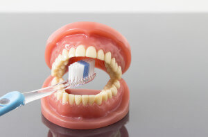dental plaque - the focus of preventive dentistry